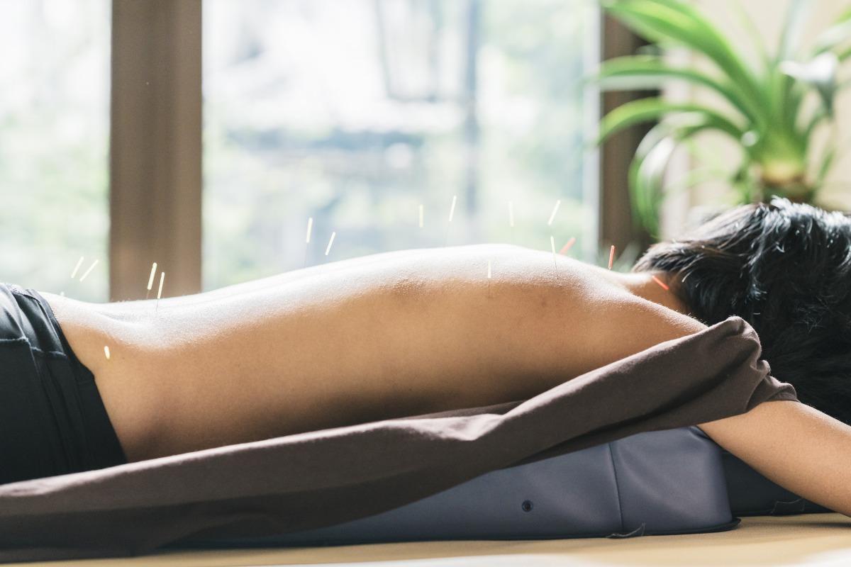 therapist-giving-cupping-treatment-to-young-asian-2021-08-26-20-17-45-utc (1)